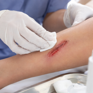 Wound Care