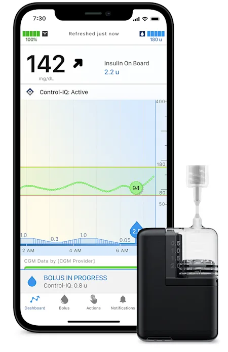 Tandem-Mobi-Insulin-Pump